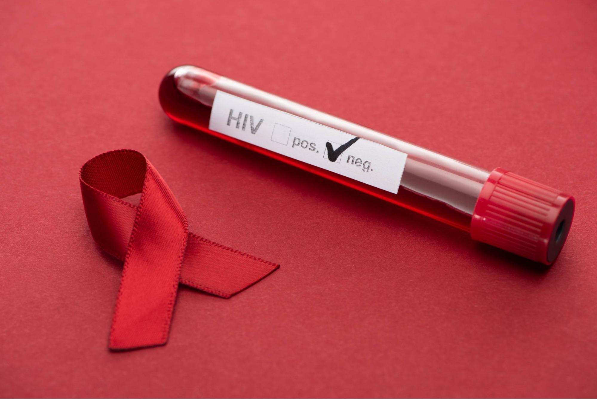 HIV test tube